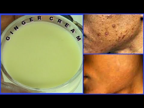 APPLY THIS GINGER CREAM TO SKIN AT NIGHT, CLEAR DARK SPOTS, ACNE SCARS, Khichi Beauty