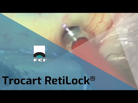 Vignette Vidéo | Trocarts Rétilock®