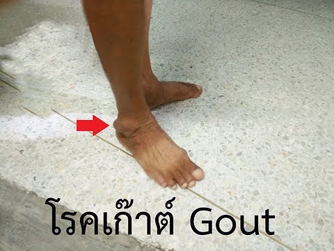 โรคเก๊าต์ gout