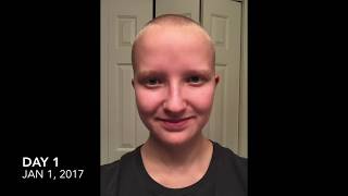 2017 Timelapse: 365 Days of Hair Growth