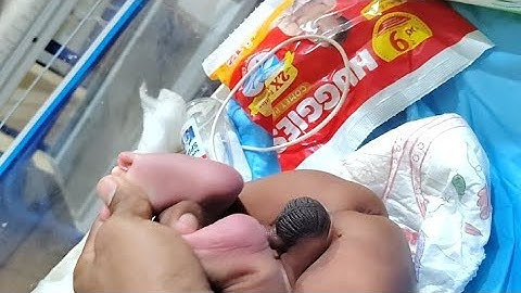 Tiny Newborn’s First Diaper Change 🍼👶 | Meconium Cleaning & Formula Feeding | NICU Care Video