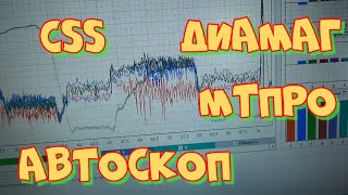 Тест эффективности на V6 моторе осциллографом Постоловского, МТПро-4.1 и Диамаг-2