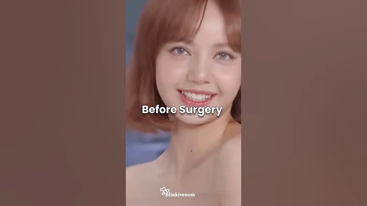 Proof that lisa got unnecessary plastic surgery#blackpink#lisa#Kpop