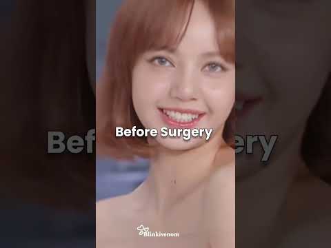 Proof that lisa