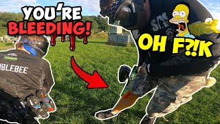 PAINTBALL FUNNY MOMENTS & FAILS ► INJURIES IN PAINTBALL 😱
