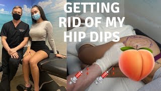 Getting Rid Of My Hip Dips !!!