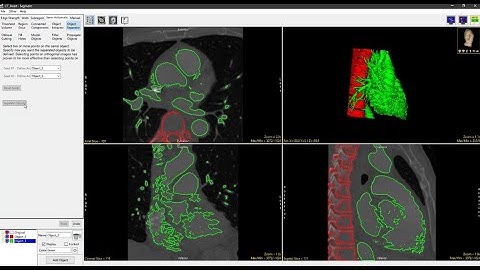Analyze 15.0 - Segment: Object Separator