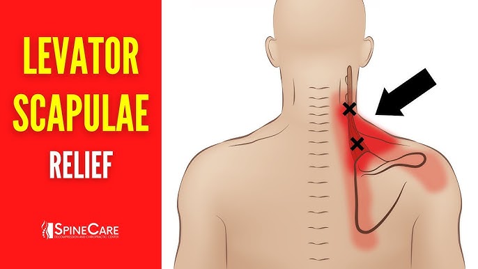 How to INSTANTLY Fix Pinched Nerve Pain in the Neck and Shoulders 