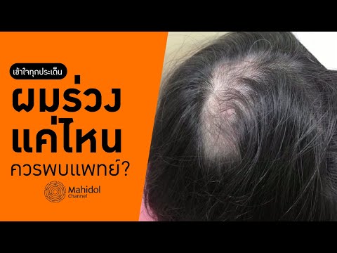 ผมร่วงแค่ไหนควรไปพบแพทย์? [หาหมอ by Mahidol Channel]