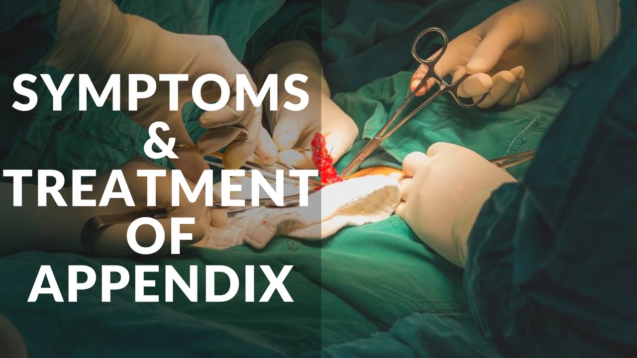 What is Treatment and Symptoms of Appendix YouTube