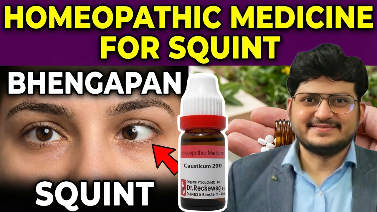 Squint | भैंगापन | Homeopathic Medicine for SQUINT ? How to use | Symptoms 
