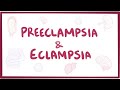 Preeclampsia & eclampsia - causes, symptoms, diagnosis, treatment, pathology