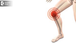 How long does it take to recover from Arthroscopic Knee Surgery? - Dr. Bala Murali Krishnan