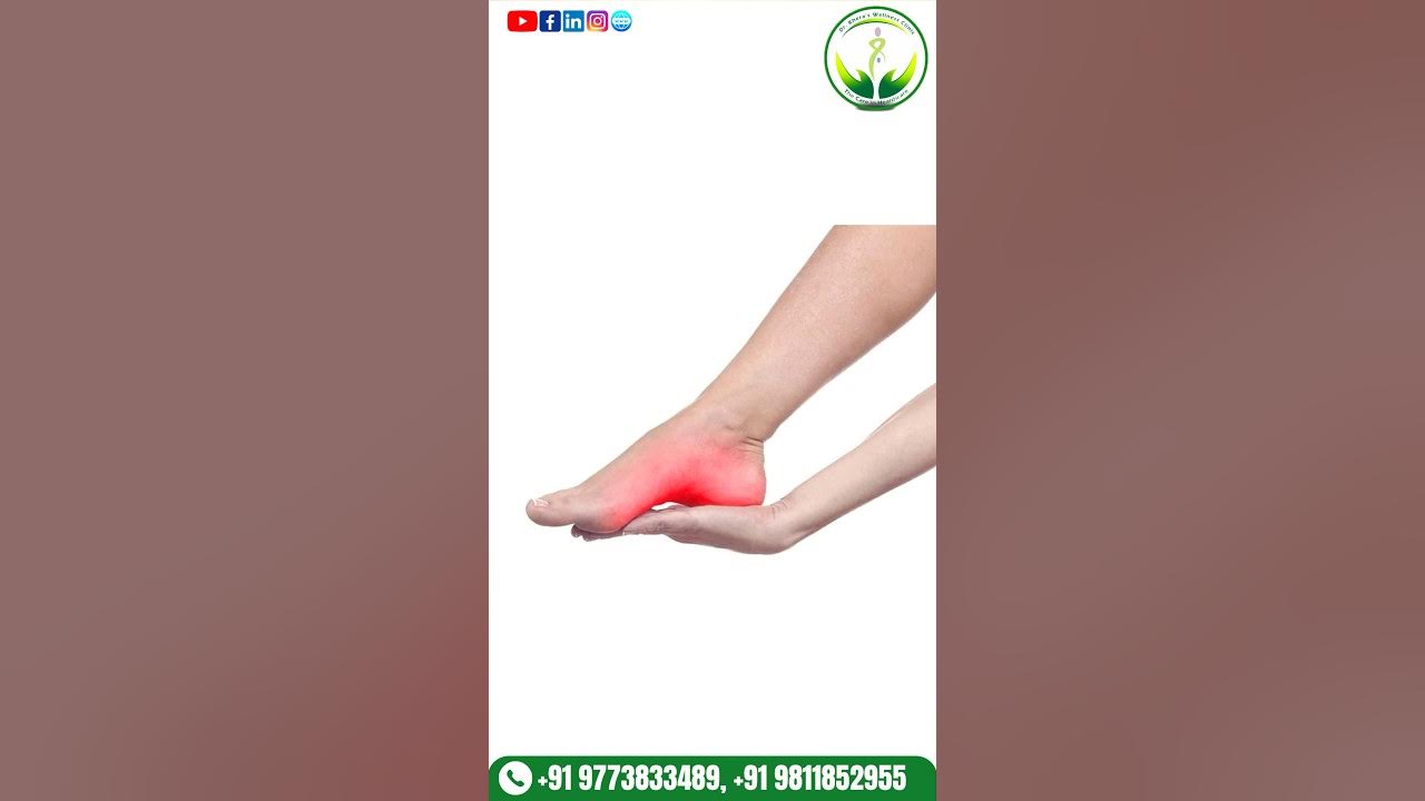why-do-i-get-heel-pain-drgauravkhera-doctor-pain-health-shorts