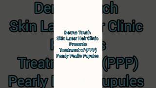 Treating Pearly Penile Papules