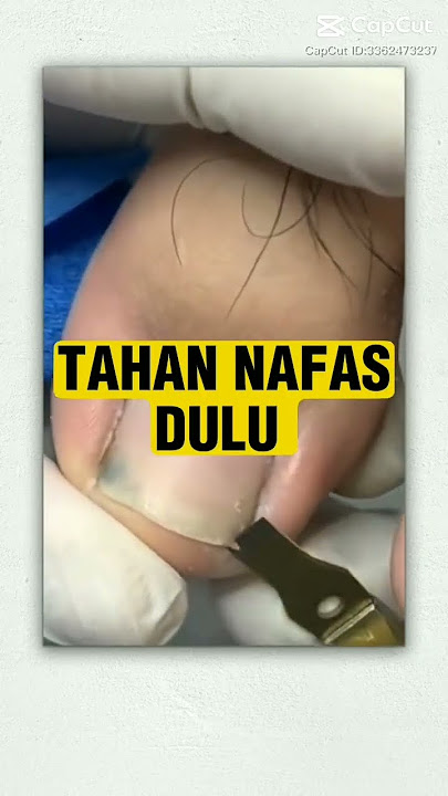 cara potong kuku cantengan