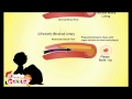 Blood Pressure and Donation Concepts