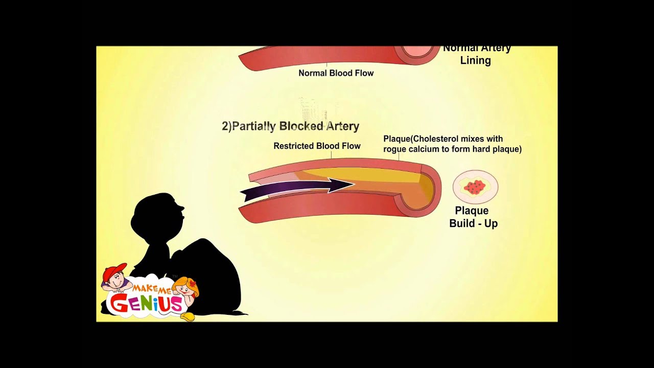 What is High & Low Blood Pressure - Video for Kids -School ...