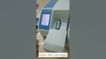 procedure of HbA1c test