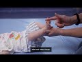 Metatarsus adductus