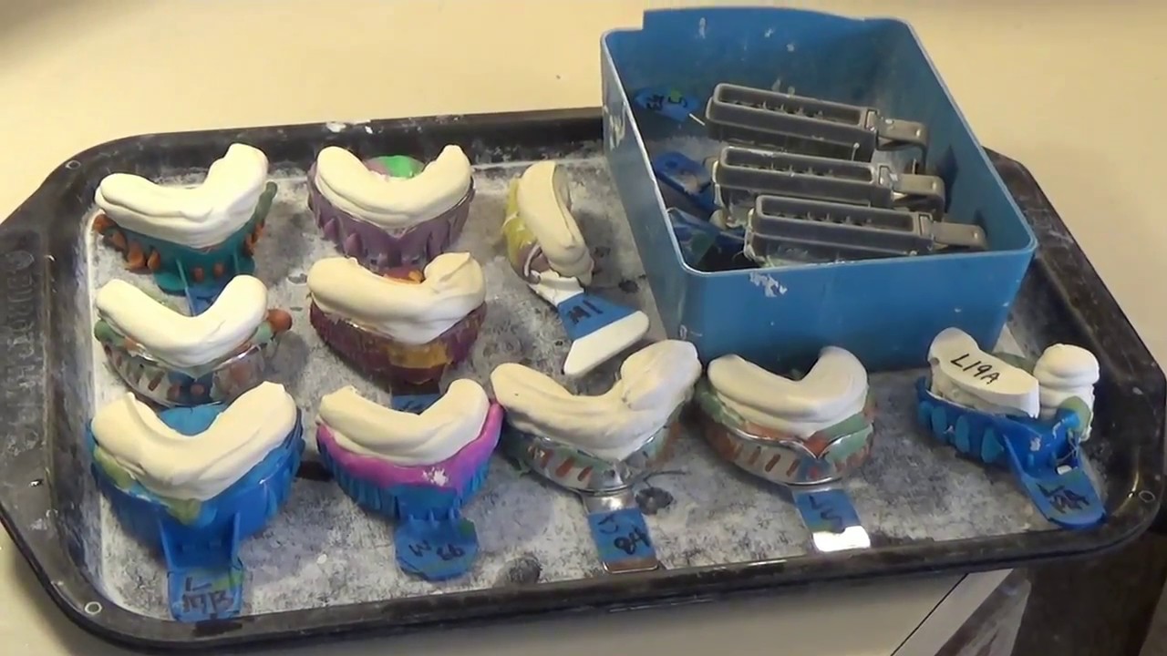 Pouring Dental Impressions YouTube