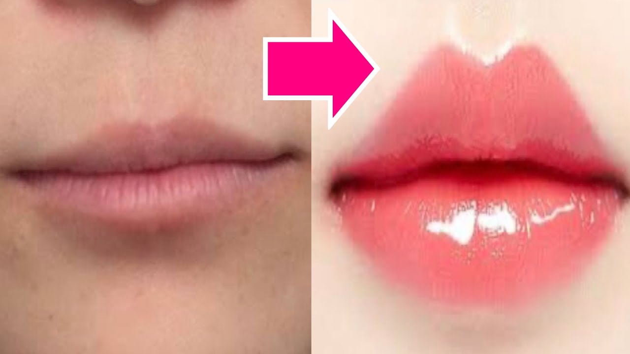 How to get a Fuller Lips without surgery