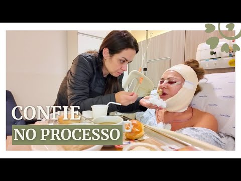 24 HORAS PÓS CIRURGIA NO ROSTO - FLAVIA CALINA