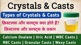 Urine Crystals & Casts in hindi | Symptoms & Types of Crystals & Casts #crystals #casts 