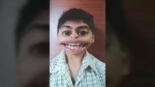 La Cara Graciosa, Aplicación Que cambia los Ojos y Boca Grande 😆 screenshot 2