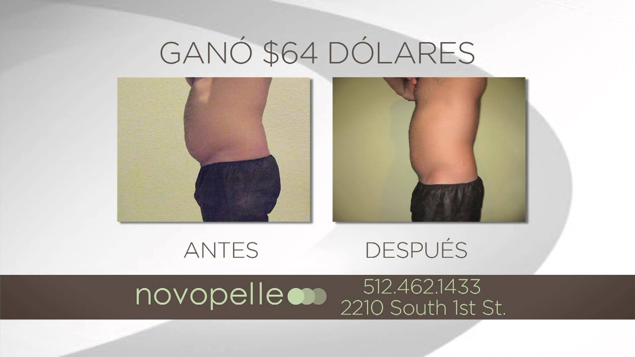 We Your Fat Weight Loss Austin Dallas Houston Spanish TV Commercial