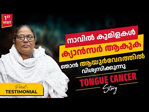 നാവിൽ കുമിളകൾ ക്യാൻസർ ആകുക. ഞാൻ ആയുർവേദത്തിൽ വിശ്വസിക്കുന്നു || Tongue Cancer Survivor Stories