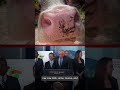 RFK Jr. Recommends Drinking Anything That Comes Out Of Cow