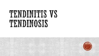 Information Tendinitis vs Tendinosis Guide