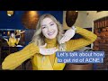 How to get rid of Problem Skin. Telling you all my beauty secrets | Anastasiia Amorim