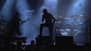 Forceps - Processing Human Brains