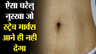 stretch marks kaise hataye - stretch marks kaise hataye in hindi |stretch marks after pregnancy |