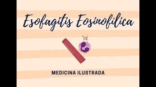 Esofagitis Eosinofílica