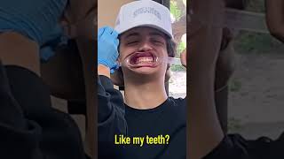 Asher Angel IGTV "Dentist" 13 Jul 2021