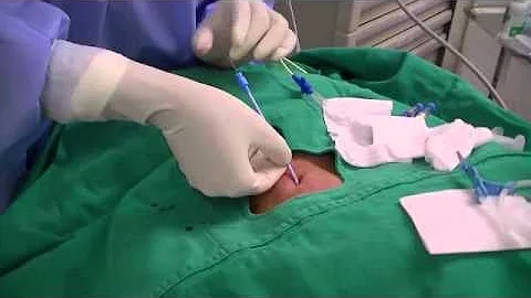 Como é feita a cirurgia de tendão?