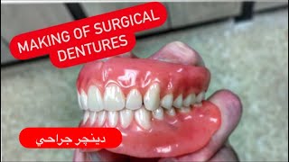 Making of immediate dentures (surgical) from impression to delivery #waxbae #dentures