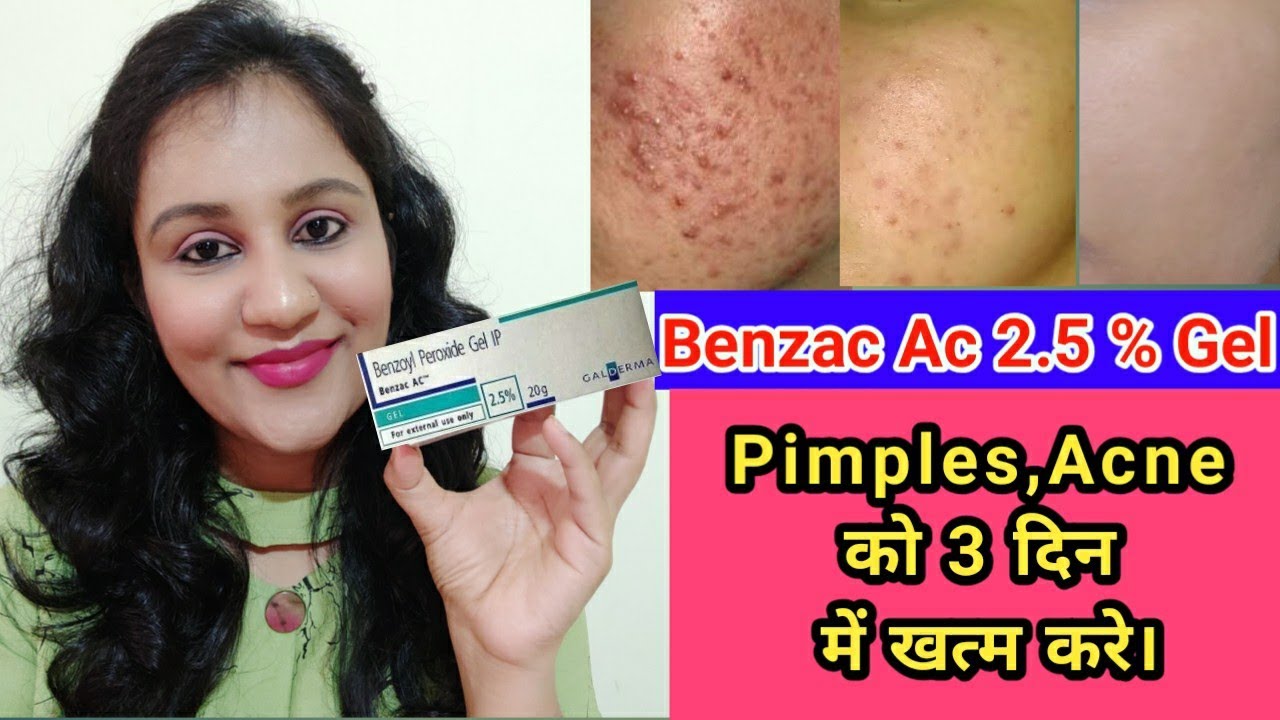 benzac acne gel