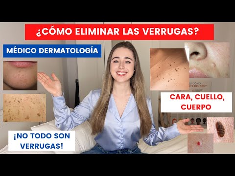 Video: Cómo tratar las ampollas menores (con imágenes)