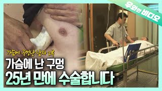 (Ep.2) The Man with a Giant Hole in His Chest and His Life After the Operation