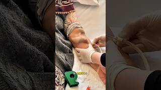 ¿Esa VENA es NORMAL? Fistula para hemodialisis