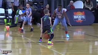 THIRD GRADER WITH JAWDROPPING