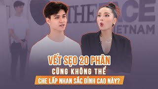 VẾT SẸO 20 PHÂN cũng không thể che lấp NHAN SẮC ĐỈNH CAO NÀY?