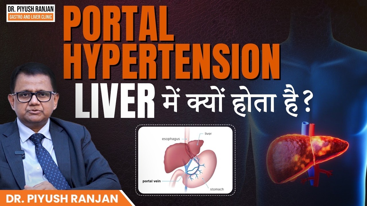 Portal Hypertension क्या है? | Causes, Symptoms & Treatment | Dr Piyush Ranjan