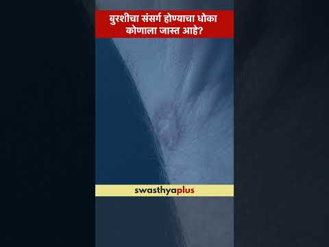 बुरशीचा संसर्ग होण्याचा धोका कोणाला जास्त आहे? | Fungal Infection: Who is at risk? |Dr Pranjal Ahire