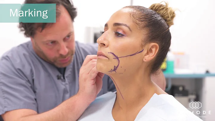 Dr Jason Altman FaceTite Treatment