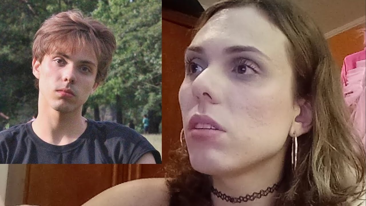 1 ANO DE TH (Mulher trans, travesti, terapia hormonal)